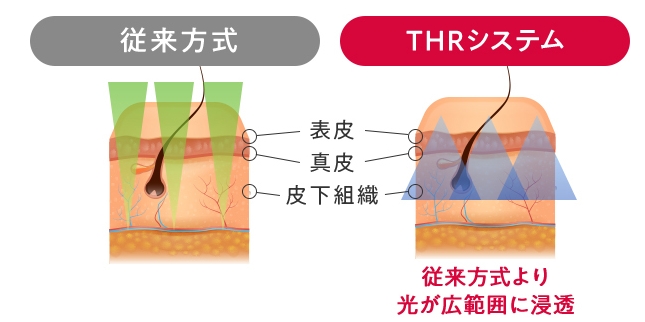 THR方式